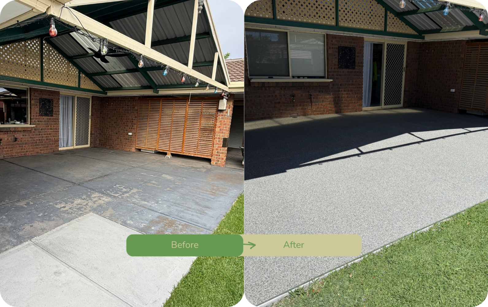 Before and After Wamberal 2