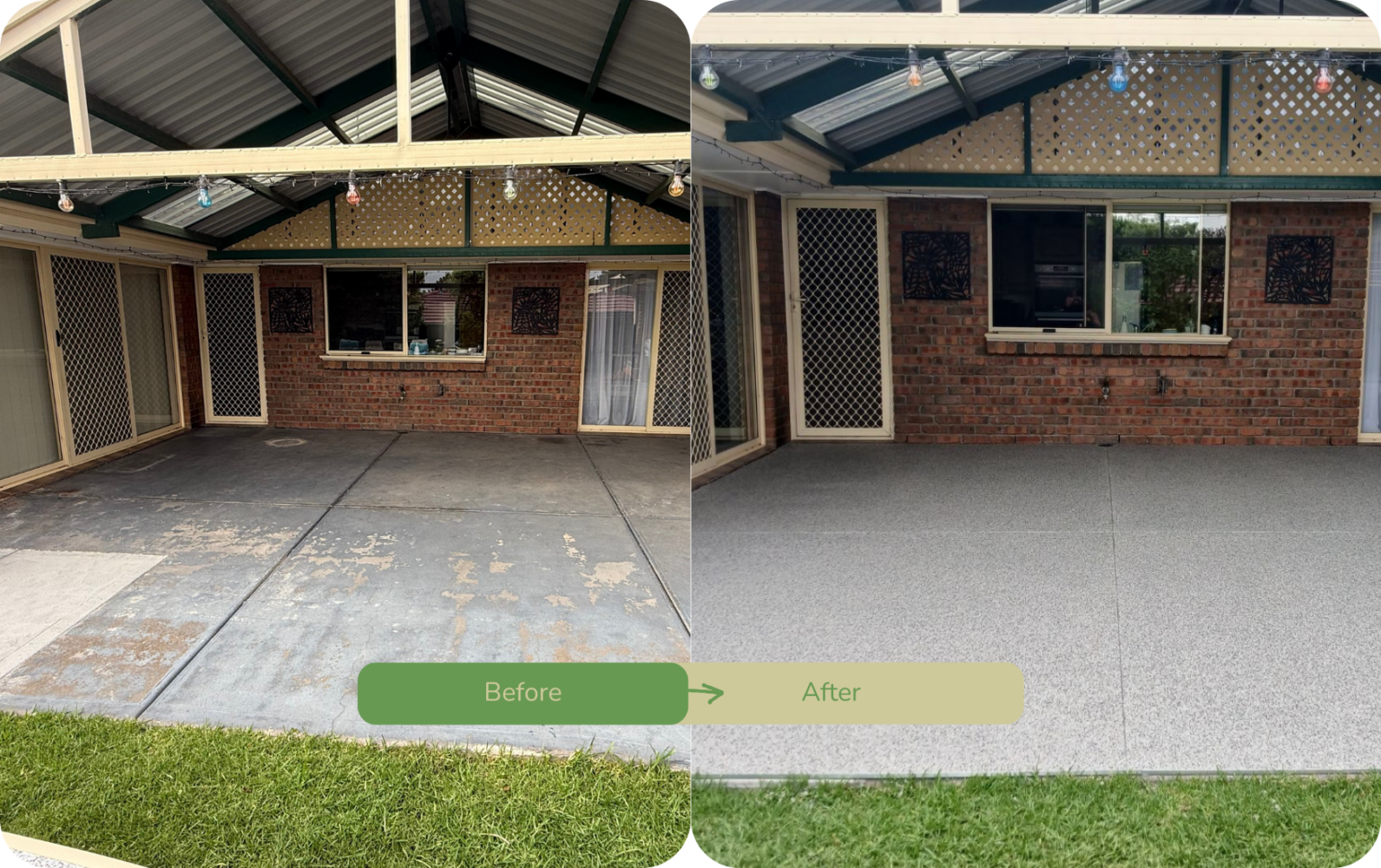 Before and After Wamberal 3